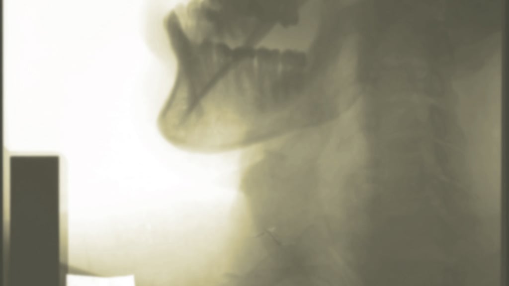 X-ray image of head and neck.